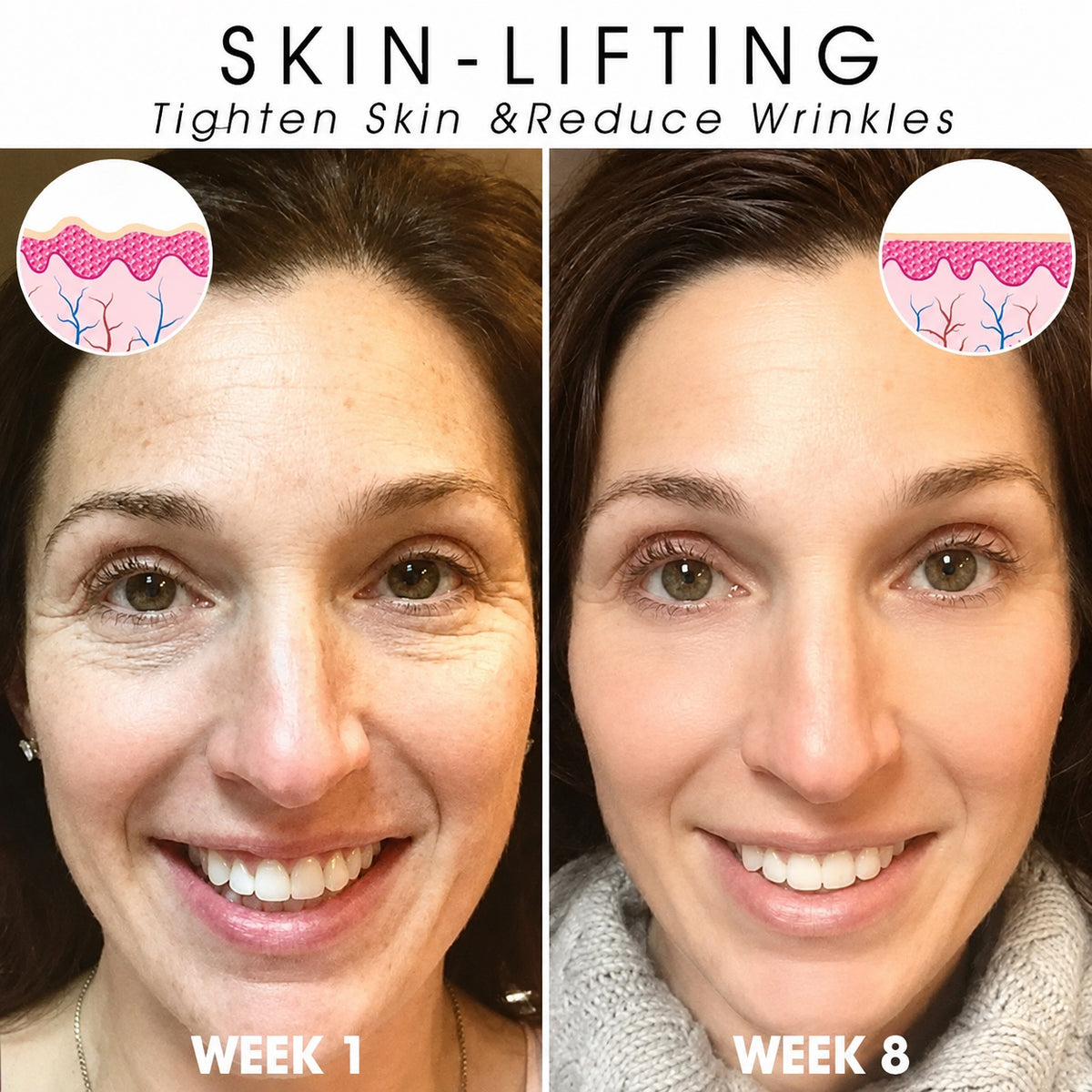 | Last Day Promotion 𝟕𝟎%𝐎𝐅𝐅🌿💝| - 💧Sparklyra® SkinFirming Rejuvenating Serum🔥