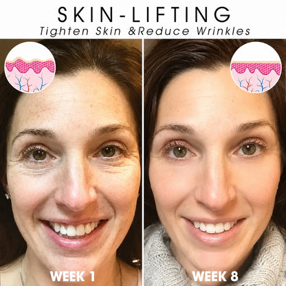 | Last Day Promotion 𝟕𝟎%𝐎𝐅𝐅🌿💝| - 💧Sparklyra® SkinFirming Rejuvenating Serum🔥