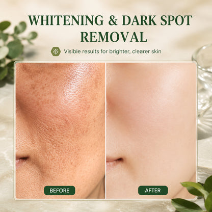 | Last Day Promotion 𝟕𝟎%𝐎𝐅𝐅🌿💝| - 💧Sparklyra® SkinFirming Rejuvenating Serum🔥