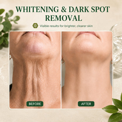 | Last Day Promotion 𝟕𝟎%𝐎𝐅𝐅🌿💝| - 💧Sparklyra® SkinFirming Rejuvenating Serum🔥
